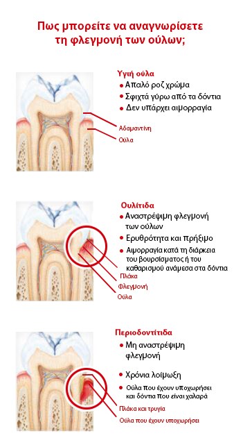 Αιτίες & Συμπτώματα